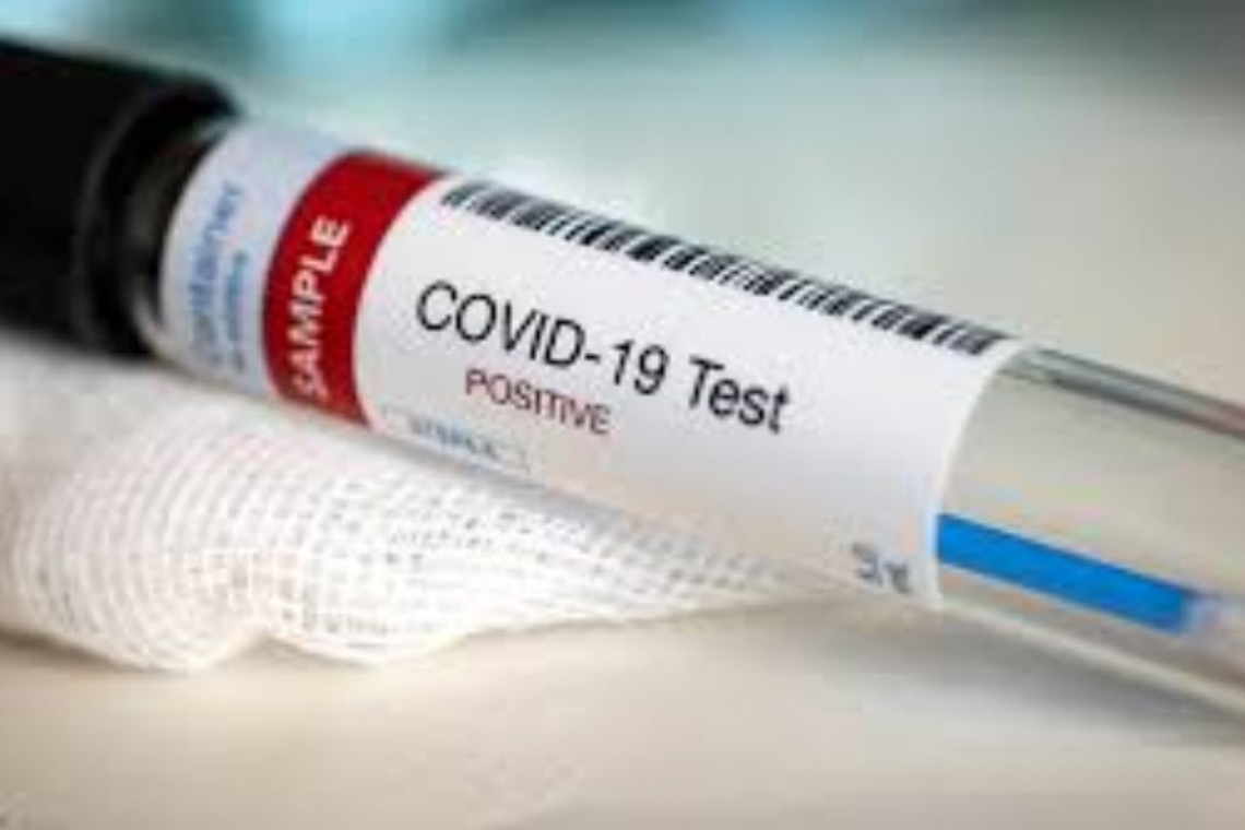 DO NOT TAKE ANY COVID-19 TEST!  Banned from Military; Can be FORCIBLY Taken from home!